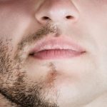 جلوگیری از ریزش موی صورت در مردان