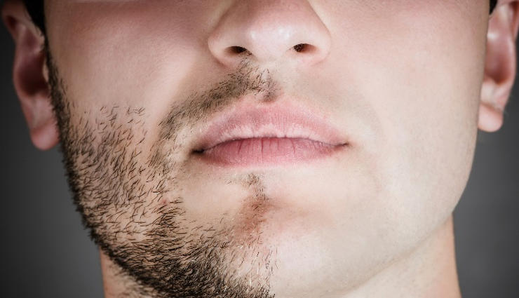 جلوگیری از ریزش موی صورت در مردان