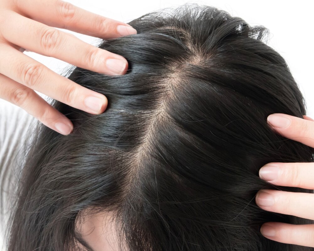 علت ریزش مو در زنان یائسه