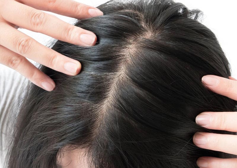 دلایل نازک شدن مو و راه های درمان